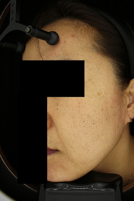 치료후기 이미지