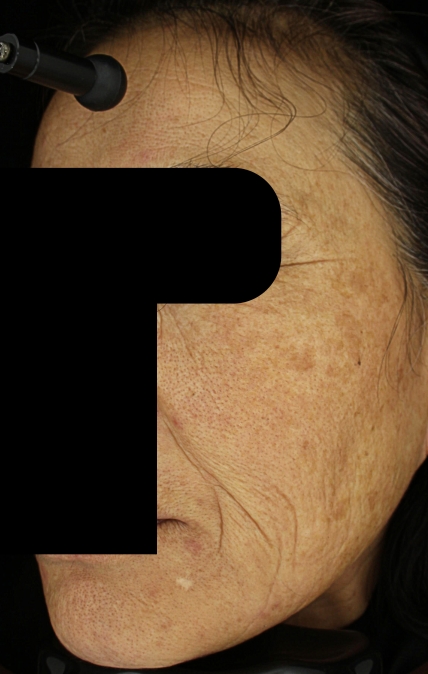 치료후기 이미지