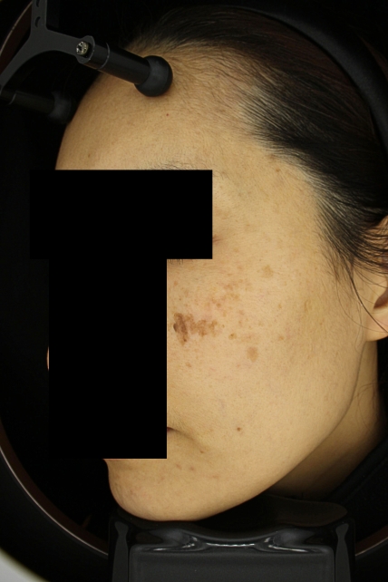 치료후기 이미지