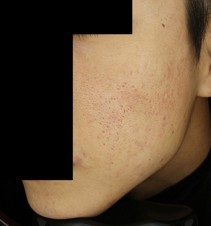 치료후기 이미지