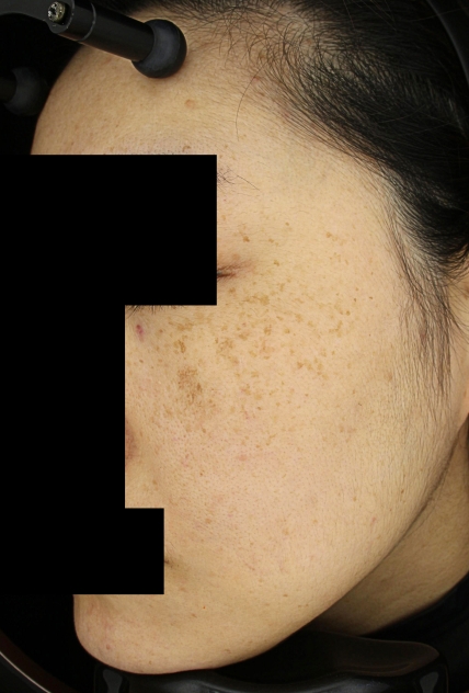 치료후기 이미지