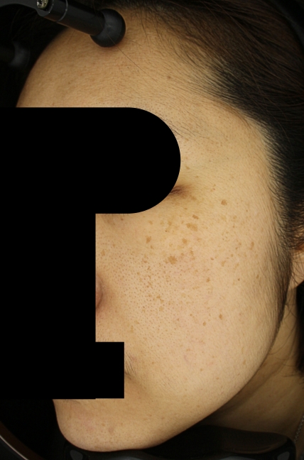 치료후기 이미지