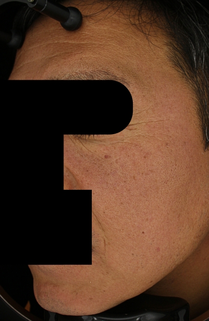 치료후기 이미지