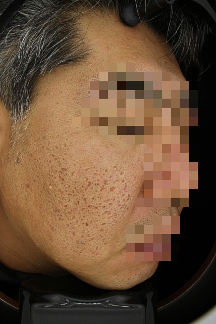 치료후기 이미지