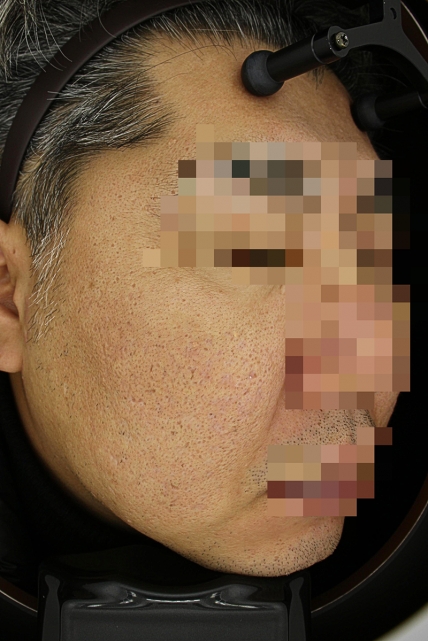 치료후기 이미지