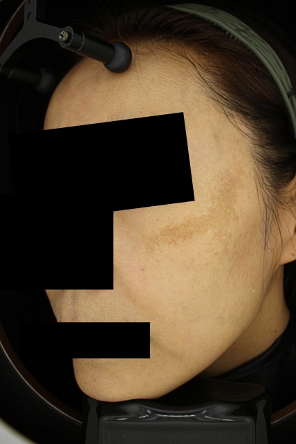 치료후기 이미지