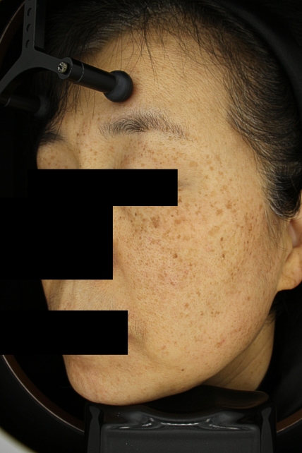 치료후기 이미지