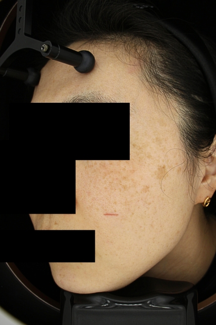 치료후기 이미지