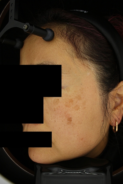 치료후기 이미지