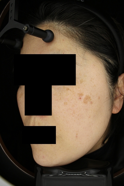 치료후기 이미지