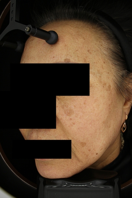 치료후기 이미지