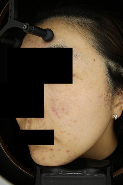 치료후기 이미지