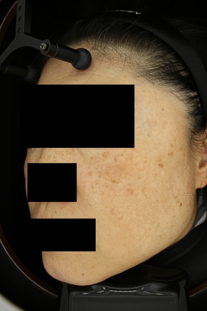 치료후기 이미지