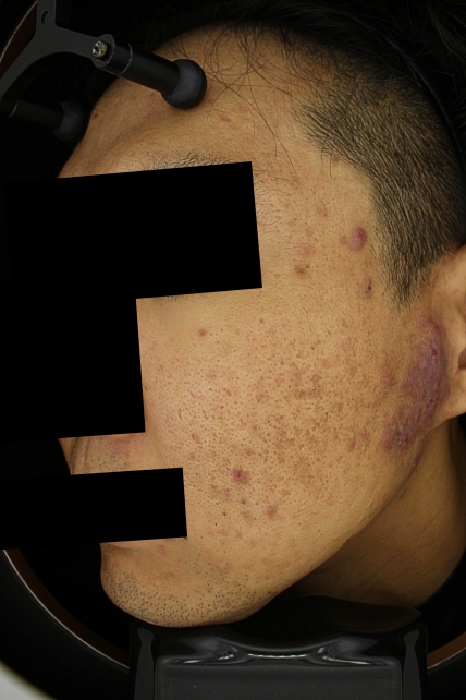 치료후기 이미지