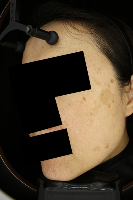 치료후기 이미지