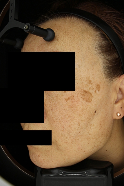 치료후기 이미지