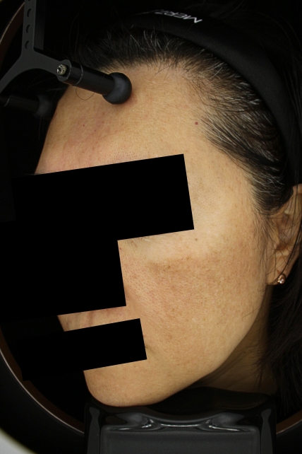 치료후기 이미지