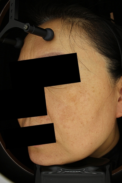 치료후기 이미지