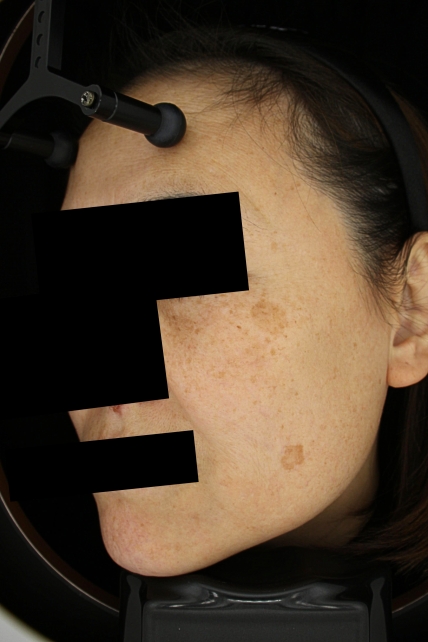 치료후기 이미지