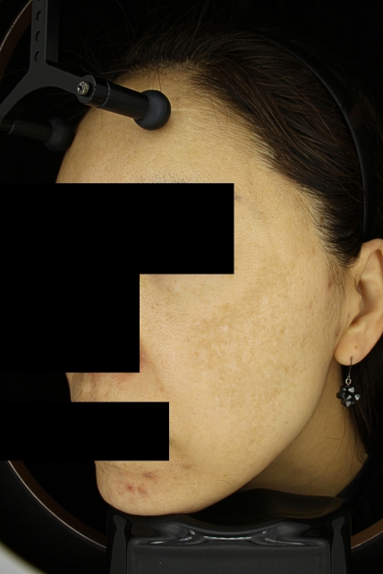 치료후기 이미지