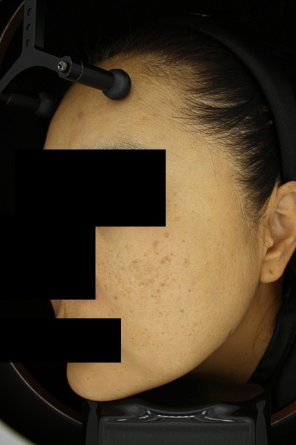 치료후기 이미지