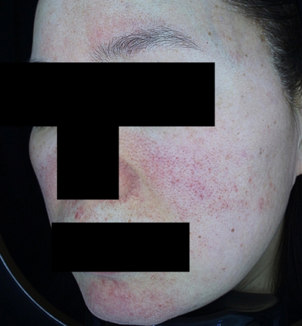 치료후기 이미지