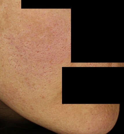 치료후기 이미지