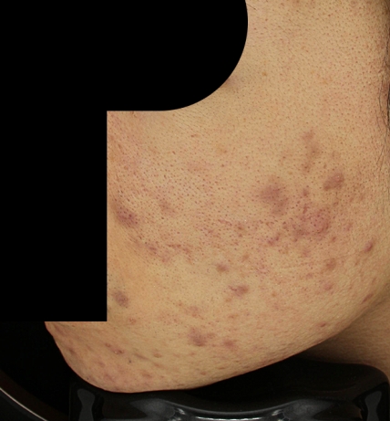 치료후기 이미지