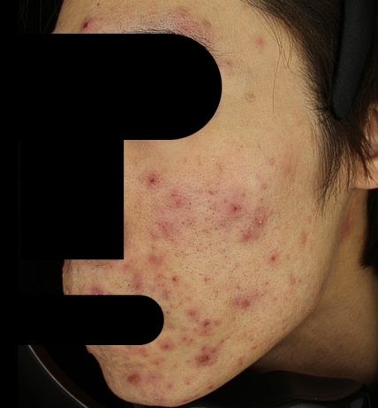 치료후기 이미지