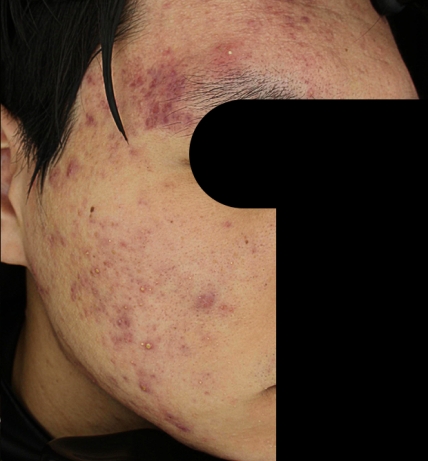 치료후기 이미지