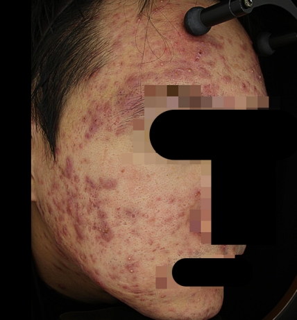 치료후기 이미지