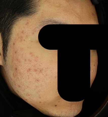 치료후기 이미지