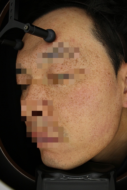 치료후기 이미지