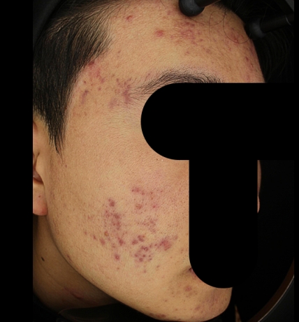 치료후기 이미지