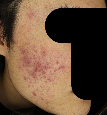 치료후기 이미지