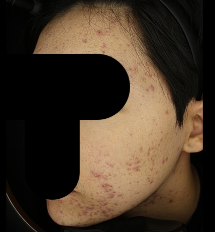 치료후기 이미지