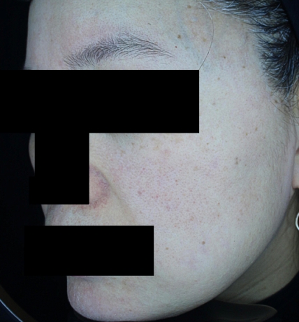 치료후기 이미지