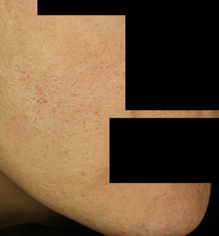 치료후기 이미지