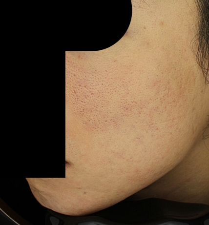 치료후기 이미지