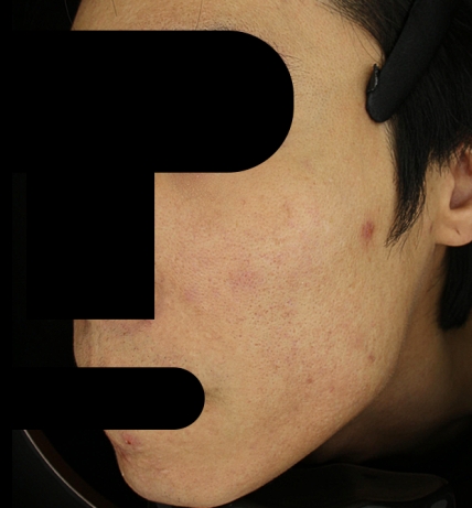 치료후기 이미지