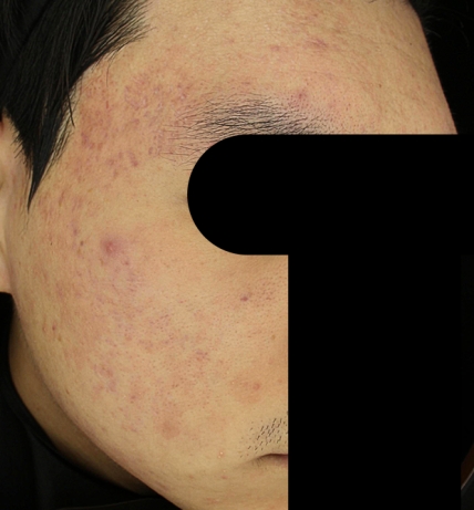 치료후기 이미지