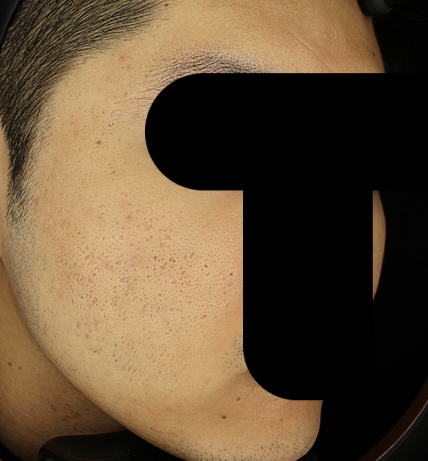 치료후기 이미지