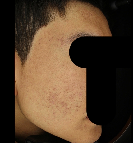 치료후기 이미지