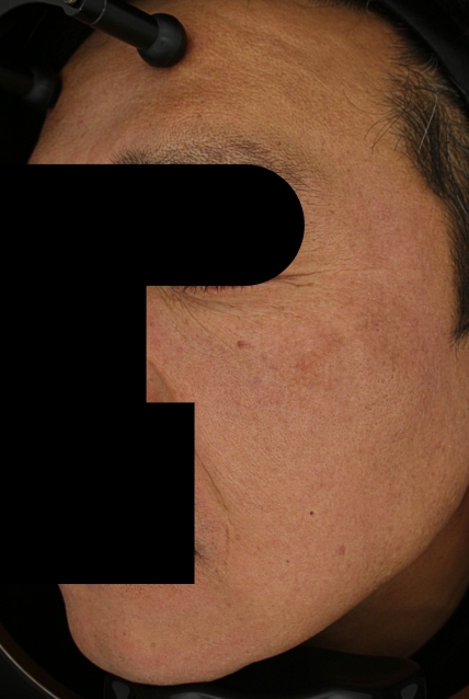 치료후기 이미지