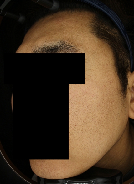 치료후기 이미지