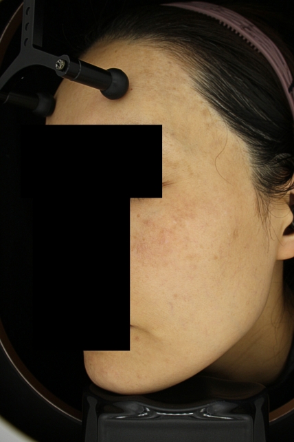 치료후기 이미지