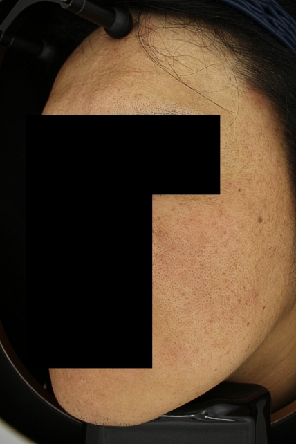 치료후기 이미지