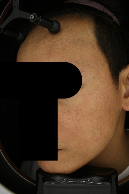 치료후기 이미지