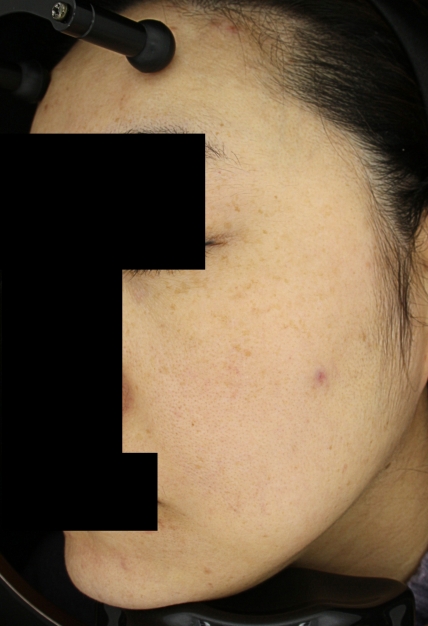 치료후기 이미지