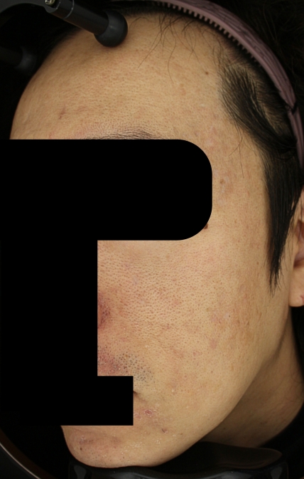 치료후기 이미지